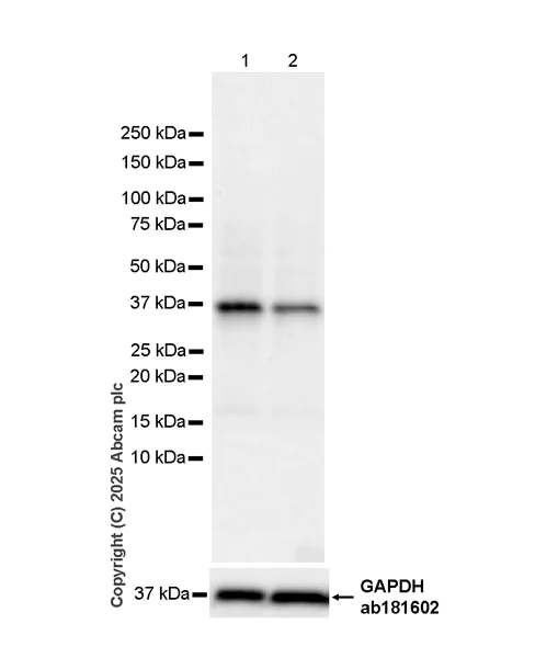 Western blot - Anti-SPO11 antibody [EPR27077-81] (AB323613)