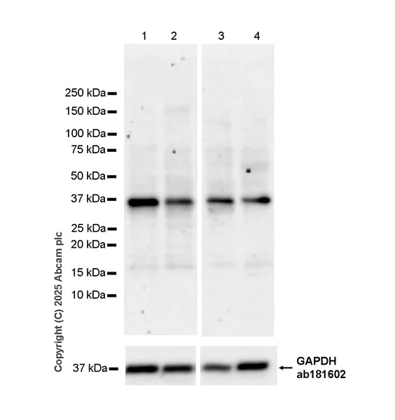 Western blot - Anti-SPO11 antibody [EPR27077-81] (AB323613)