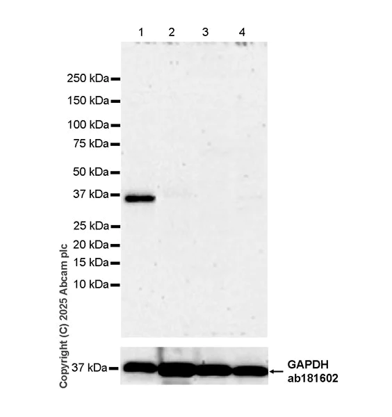 Western blot - Anti-SPO11 antibody [EPR27077-81] (AB323613)
