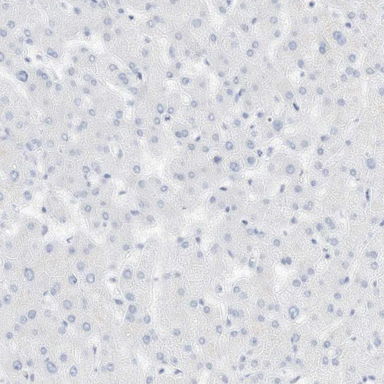 Immunohistochemistry (Formalin/PFA-fixed paraffin-embedded sections) - Anti-SPOCD1 antibody (AB122188)