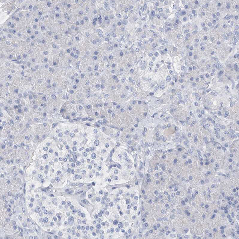 Immunohistochemistry (Formalin/PFA-fixed paraffin-embedded sections) - Anti-SPOCD1 antibody (AB122188)