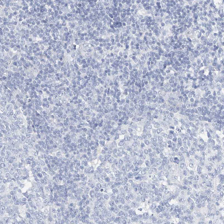 Immunohistochemistry (Formalin/PFA-fixed paraffin-embedded sections) - Anti-SPOCD1 antibody (AB122188)
