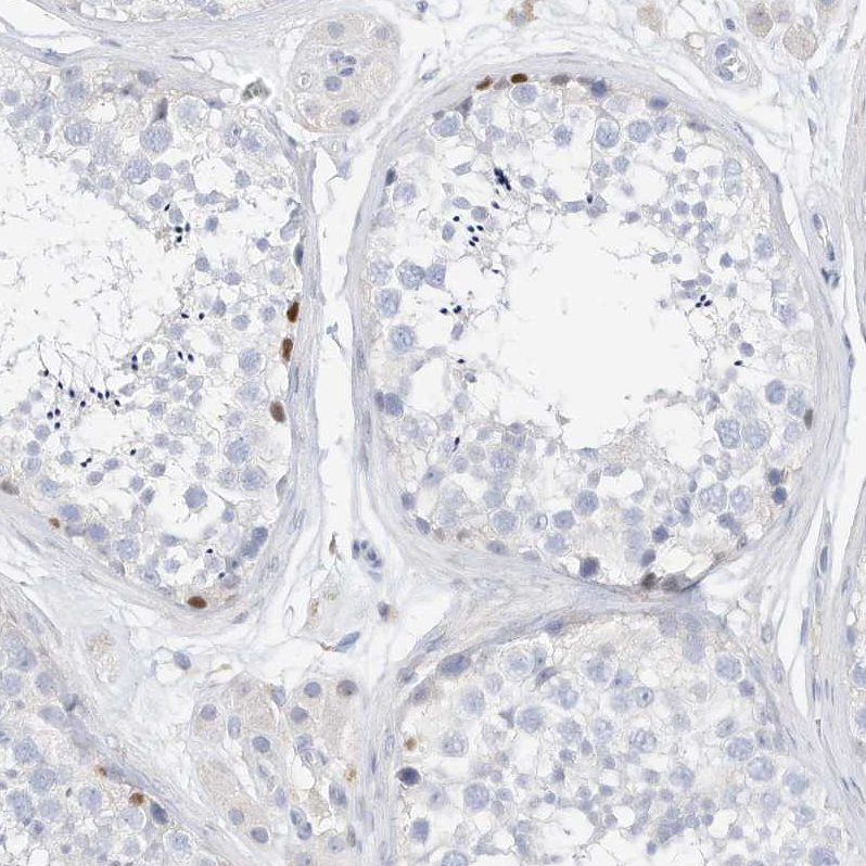 Immunohistochemistry (Formalin/PFA-fixed paraffin-embedded sections) - Anti-SPOCD1 antibody (AB122188)