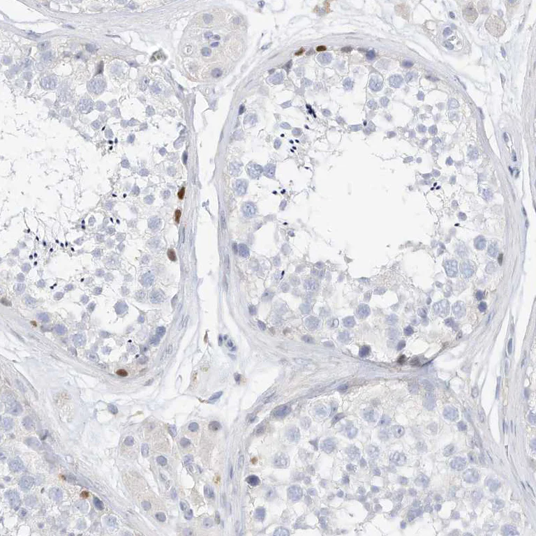 Immunohistochemistry (Formalin/PFA-fixed paraffin-embedded sections) - Anti-SPOCD1 antibody (AB122188)