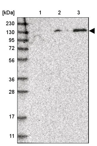 Western blot - Anti-SPOCD1 antibody (AB122188)