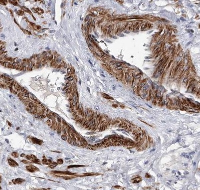 Immunohistochemistry (Formalin/PFA-fixed paraffin-embedded sections) - Anti-SPOCK1 antibody (AB224071), expandable thumbnail