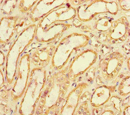 Immunohistochemistry (Formalin/PFA-fixed paraffin-embedded sections) - Anti-SPOCK1 antibody (AB229935)