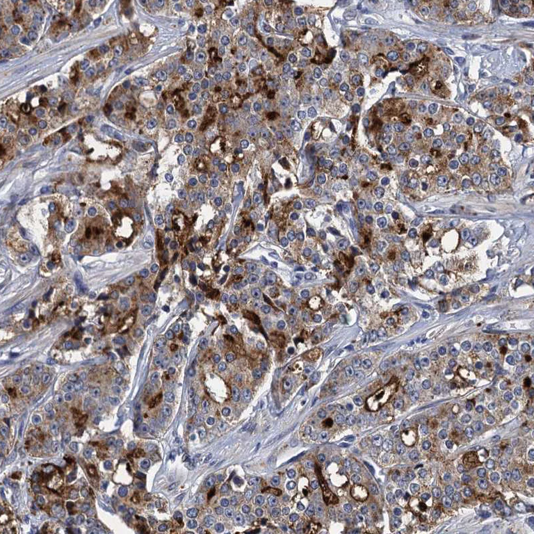 Immunohistochemistry (Formalin/PFA-fixed paraffin-embedded sections) - Anti-SPON2 antibody (AB215451)