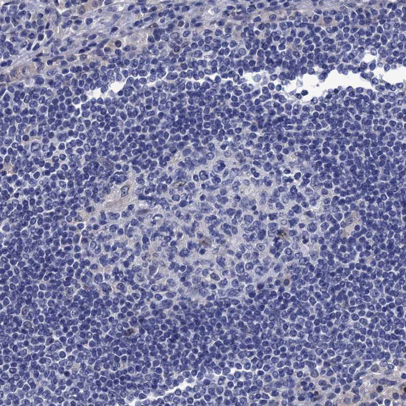 Immunohistochemistry (Formalin/PFA-fixed paraffin-embedded sections) - Anti-SPON2 antibody (AB215451)