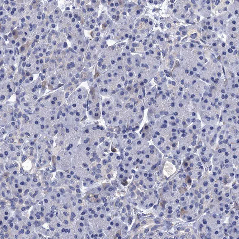 Immunohistochemistry (Formalin/PFA-fixed paraffin-embedded sections) - Anti-SPON2 antibody (AB215451)