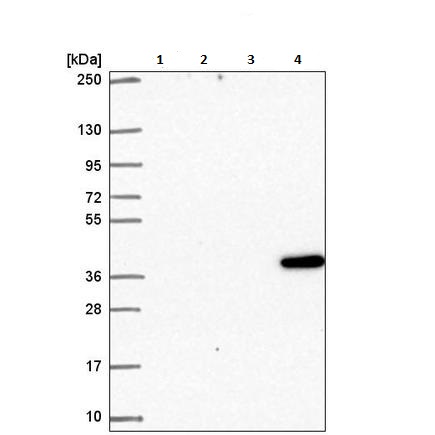 Western blot - Anti-SPON2 antibody (AB221649), expandable thumbnail