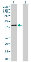 Western blot - Anti-SPOP antibody (AB168619)