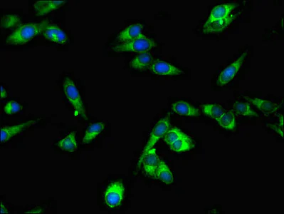 Immunocytochemistry/ Immunofluorescence - Anti-SPPL2a antibody (AB237691)