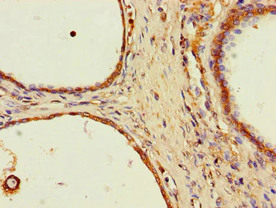 Immunohistochemistry (Formalin/PFA-fixed paraffin-embedded sections) - Anti-SPPL2a antibody (AB237691)