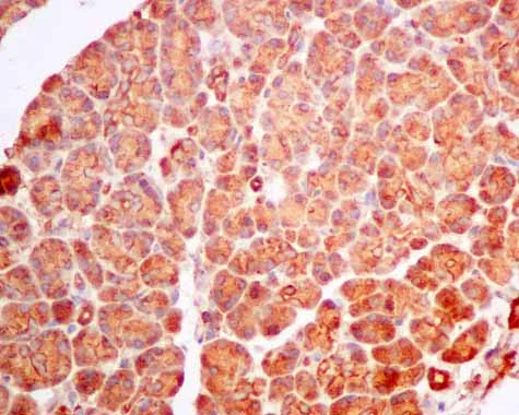 Immunohistochemistry (Formalin/PFA-fixed paraffin-embedded sections) - Anti-SPR antibody [EPR9290] (AB157194)