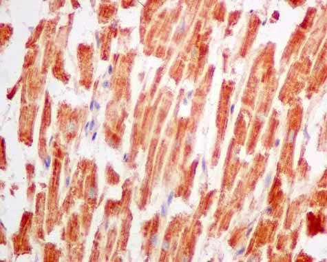 Immunohistochemistry (Formalin/PFA-fixed paraffin-embedded sections) - Anti-SPR antibody [EPR9290] (AB157194)
