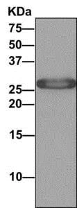 Immunoprecipitation - Anti-SPR antibody [EPR9290] (AB157194)