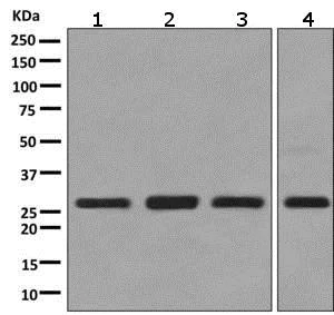 Western blot - Anti-SPR antibody [EPR9290] (AB157194)