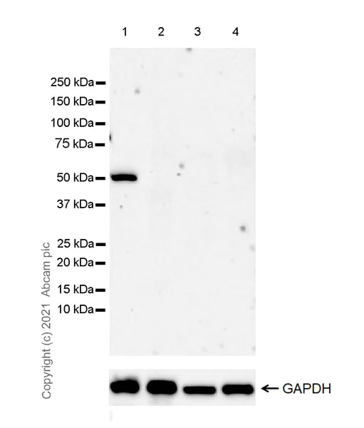 Western blot - Anti-SPRED1 antibody [EPR24412-120] (AB271191)
