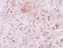 Immunohistochemistry (Formalin/PFA-fixed paraffin-embedded sections) - Anti-SPRED2 antibody (AB153700)