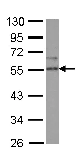 Western blot - Anti-SPRED2 antibody (AB153700)