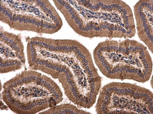 Immunohistochemistry (Formalin/PFA-fixed paraffin-embedded sections) - Anti-Sprouty 4/Spry-4 antibody (AB228712), expandable thumbnail
