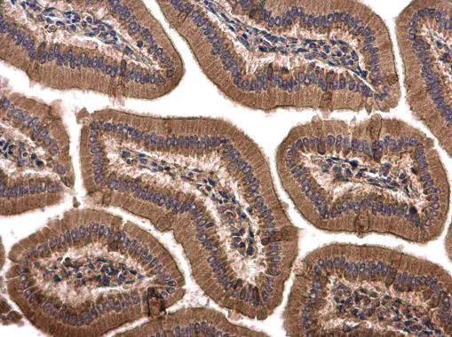 Immunohistochemistry (Formalin/PFA-fixed paraffin-embedded sections) - Anti-Sprouty 4/Spry-4 antibody (AB228712)