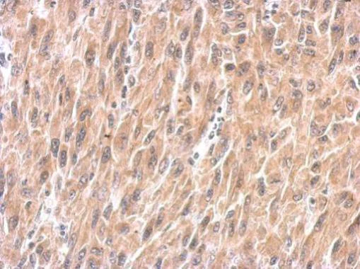 Immunohistochemistry (Formalin/PFA-fixed paraffin-embedded sections) - Anti-Sprouty 4/Spry-4 antibody (AB228712)