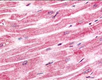 Immunohistochemistry (Formalin/PFA-fixed paraffin-embedded sections) - Anti-Sprouty 4/Spry-4 antibody (AB7513)