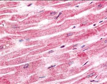 Immunohistochemistry (Formalin/PFA-fixed paraffin-embedded sections) - Anti-Sprouty 4/Spry-4 antibody (AB7513)