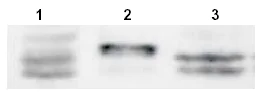 Western blot - Anti-Sprouty 4/Spry-4 antibody (AB7513)