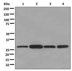Western blot - Anti-Sprouty 4/Spry-4 antibody [EPR12127] (AB176337)