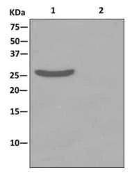 Immunoprecipitation - Anti-Sprouty 4/Spry-4 antibody [EPR12127] - BSA and Azide free (AB238934)