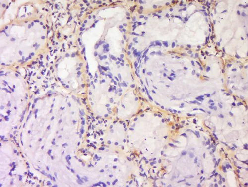 Immunohistochemistry (Formalin/PFA-fixed paraffin-embedded sections) - Anti-SPRR3 antibody (AB218131)