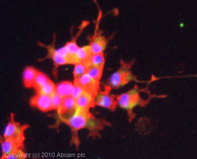 Immunocytochemistry/ Immunofluorescence - Anti-Spry-2 antibody (AB85670)