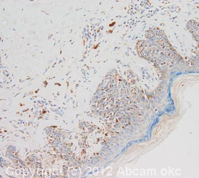 Immunohistochemistry (Formalin/PFA-fixed paraffin-embedded sections) - Anti-Spry-2 antibody (AB85670)