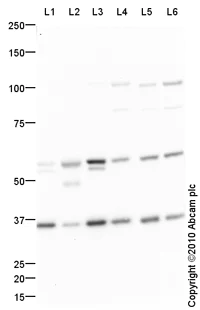 Western blot - Anti-Spry-2 antibody (AB85670)