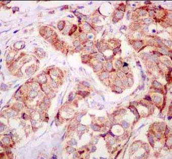 Immunohistochemistry (Formalin/PFA-fixed paraffin-embedded sections) - Anti-Spry-2 antibody [EPR4318(2)(B)] (AB180527)
