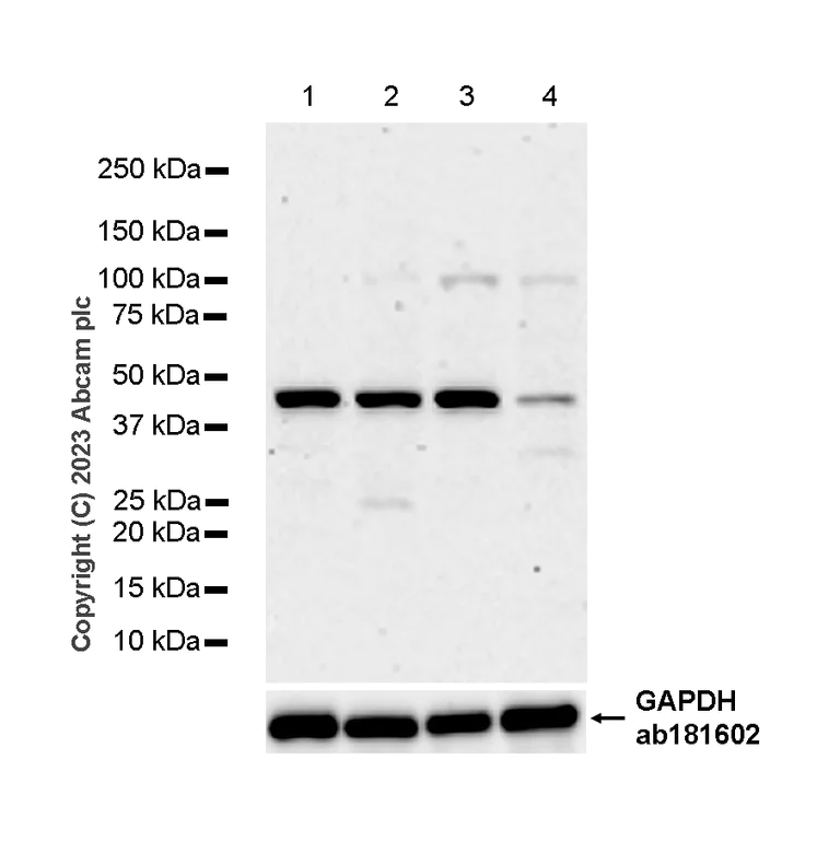 Western blot - Anti-Spry-2 antibody [EPR4318(2)(B)] - BSA and Azide free (AB250224)
