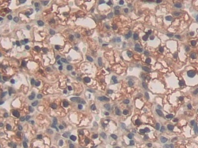 Immunohistochemistry (Formalin/PFA-fixed paraffin-embedded sections) - Anti-SPRY3 antibody (AB233424), expandable thumbnail