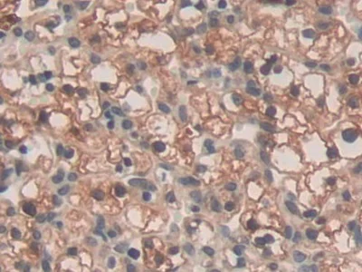 Immunohistochemistry (Formalin/PFA-fixed paraffin-embedded sections) - Anti-SPRY3 antibody (AB233424)