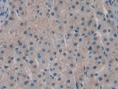 Immunohistochemistry (Formalin/PFA-fixed paraffin-embedded sections) - Anti-SPRY3 antibody (AB233424)