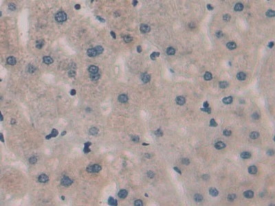 Immunohistochemistry (Formalin/PFA-fixed paraffin-embedded sections) - Anti-SPRY3 antibody (AB233424), expandable thumbnail