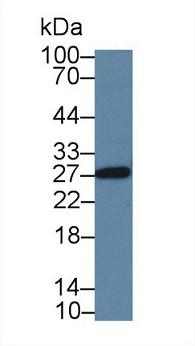 Western blot - Anti-SPRY3 antibody (AB233424), expandable thumbnail