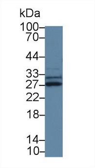 Western blot - Anti-SPRY3 antibody (AB233424), expandable thumbnail