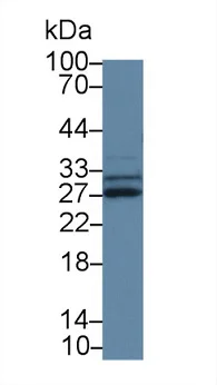 Western blot - Anti-SPRY3 antibody (AB233424)