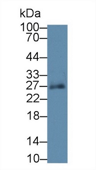 Western blot - Anti-SPRY3 antibody (ab233424), expandable thumbnail