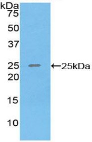 Western blot - Anti-SPRY3 antibody (ab233424), expandable thumbnail