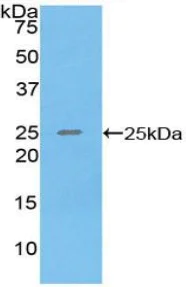 Western blot - Anti-SPRY3 antibody (AB233424)