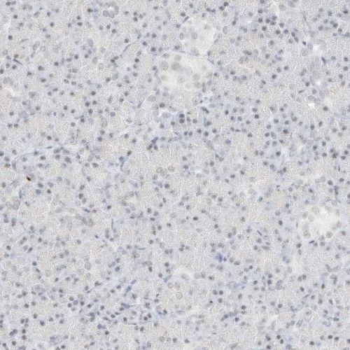 Immunohistochemistry (Formalin/PFA-fixed paraffin-embedded sections) - Anti-SPT5 antibody (AB244429), expandable thumbnail